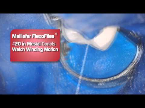 Dentsply FlexoFile  - Review by Dr. Scott Norton