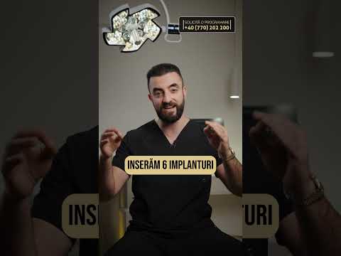 Parodontoza și implanturile dentare – opțiuni de reabilitare orală