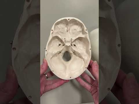 Title: Questions I Hear as an Anatomy Professor - Ep. 2: Where's the Middle Meningeal Artery?