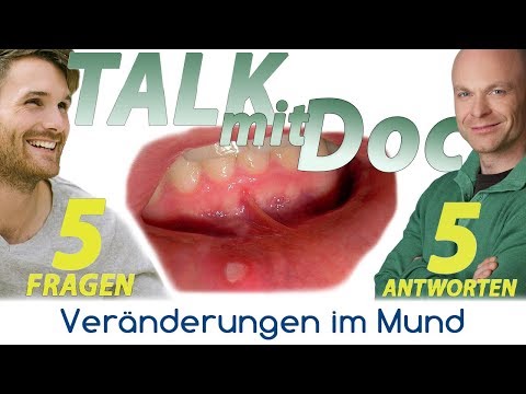 Talk mit Doc-weißer Fleck im Mund