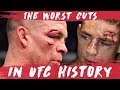 The Worst Cuts in UFC History