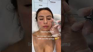 Dermal Filler for midface volume loss