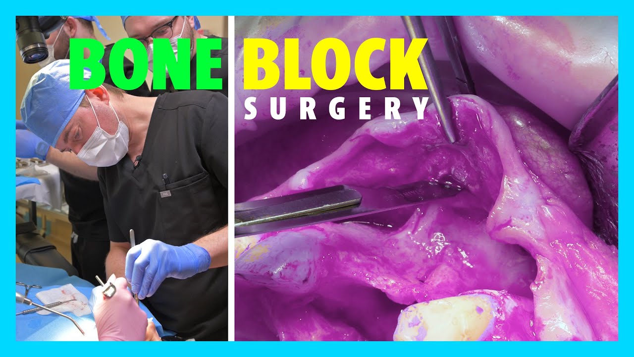 Surgical Technique 1