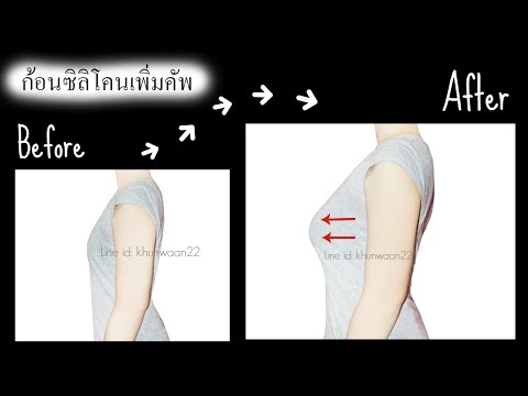 สิ่งที่ฉันอายุ 14 ปี แต่หน้าอกยังคงมีขนาดเล็ก ยาเพิ่มขนาดเต้านม