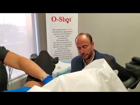 O Shot treatment for Lichen Sclerosus, Steinberg Urology Montreal