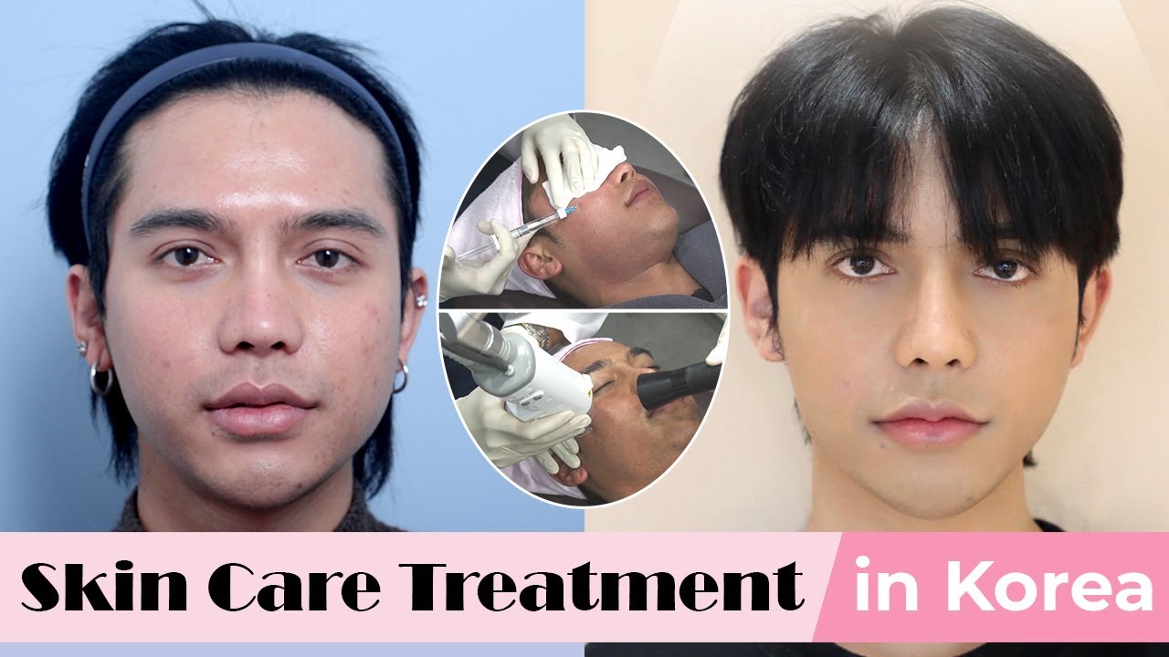 Korean skin care treatment for acne scars pores wrinkles rejuvenation before and after NANA YouTube video