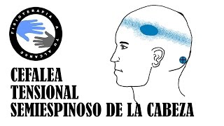 Dolor de cabeza,  masaje del musculo semiespinoso de la cabeza para la cefalea tensional