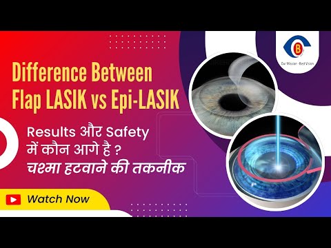 Difference between Epi-LASIK vs Flap LASIK Surgery - Thin Cornea के लिए कौन सही है, जानिए फर्क?