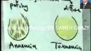 general pathology 10: fatty degeneration  and amyloid1 DR SAMEH GHAZY