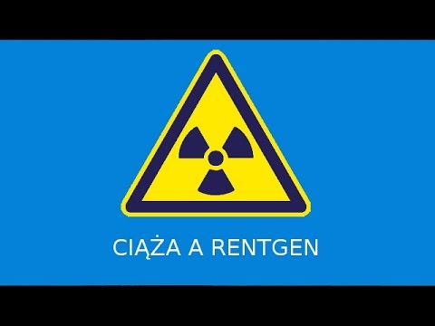 Operacja rehabilitacja halyus koślawego Ból nóg po operacji koślawego