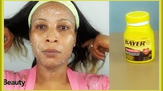 USE ASPIRIN FACIAL PEEL | Look 5 Years Younger | Get Fresh Youthful Looking Skin| Khichi Beauty