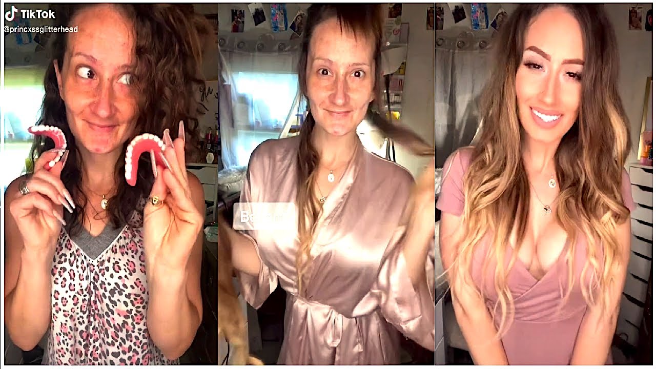 RAGAZZA SENZA DENTI METTE UN VIDEO SU TIK TOK: IL PRIMA E DOPO E' IMBARAZZANTE.