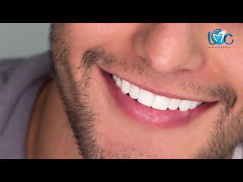 Francisco Zuluaga  desafio 2017 Diseño de sonrisa Lina Cataño Lmc