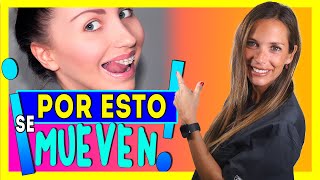 😳¿Es NORMAL sentir los 𝐃𝐈𝐄𝐍𝐓𝐄𝐒 𝐅𝐋𝐎𝐉𝐎𝐒 CON 𝘽𝙍𝘼𝘾𝙆𝙀𝙏𝙎 👅Como se mueven los dientes en ORTODONCIA