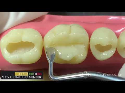 Lm arte Replica posterior by Styleitaliano - Replica of lower 6