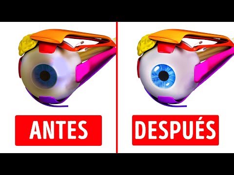 Ejercicios Oculares, ¡10 Minutos Al Día Para Mejorar La Vista!