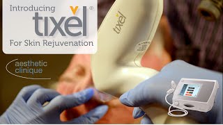 Introducing The Brand New Tixel For Skin Rejuvenation - Steven F. Weiner, MD