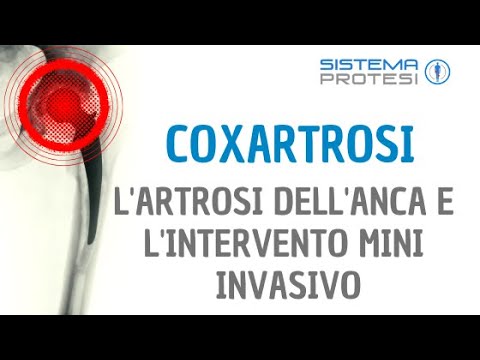 Un aumento del pollice Di gravidanza 25 settimane, dolore nella parte destra inferiore della schiena
