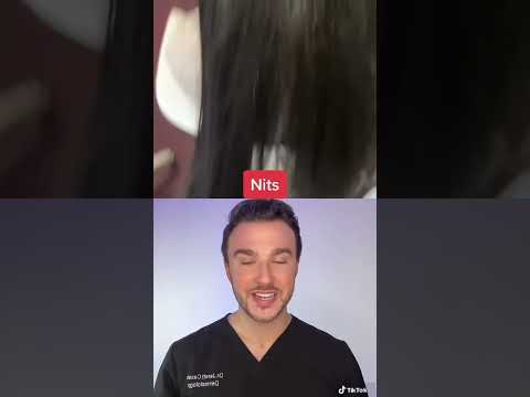 Dermatologist reacts to a bad case of head lice #shorts