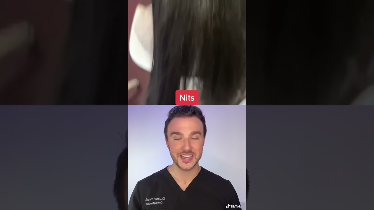 Dermatologist reacts to a bad case of head lice #shorts