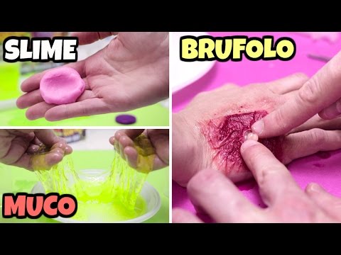 Un occhio da ormoni si è gonfiato Maschera sulla persona da fiocchi