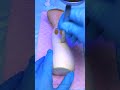 Mushroom Needs Surgery Twins Were Born Shorts