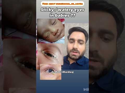 Watery / Sticky Eyes In Babies ..#viral #trending #parenting #wateryeyes #newborn #yt #ytshorts
