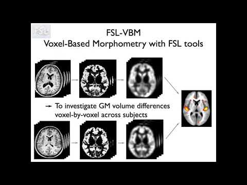 10. Segmentation: Structural Analysis using FSL VBM and SIENA (Struc E4)
