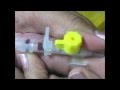 Cannulation Technique In Neonate 