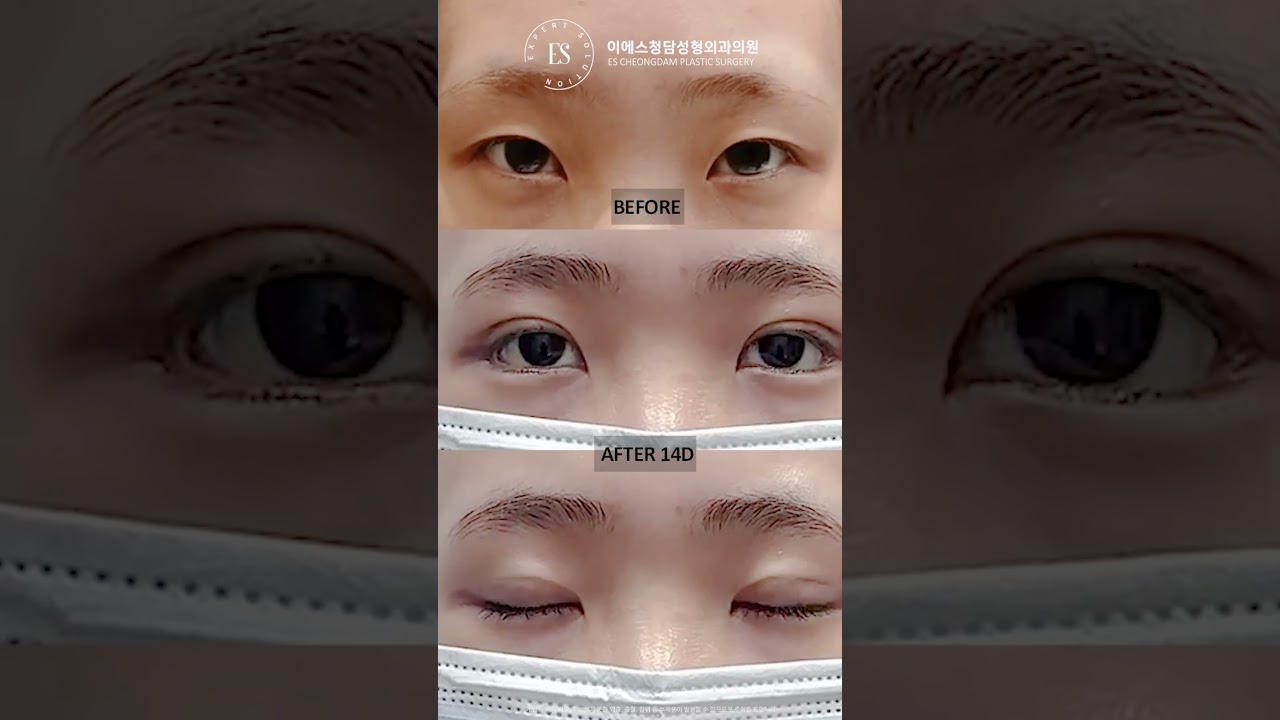 이에스 유튜브