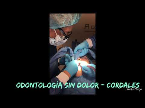 Cordales sin dolor Dra Figueredo R