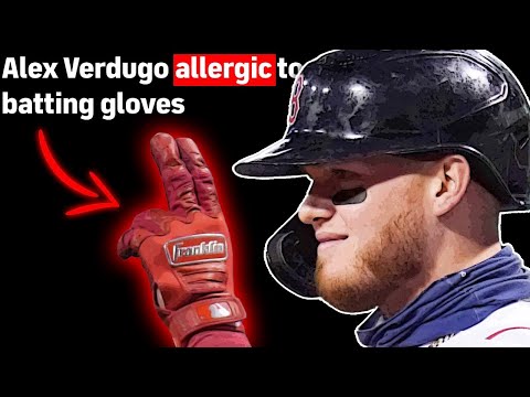 MLB Players With WEIRD Weaknesses