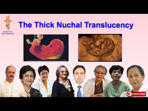 The Thick Nuchal Translucency