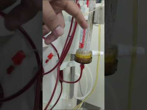 Plasma Flux P2 Dry Filter 5008031