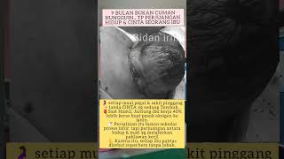 Download lagu luar biasa perjuangan seorang ibu #edukasikesehatan #videoedukasi  #viral mp3 Download lagu luar biasa perjuangan seorang ibu #edukasikesehatan #videoedukasi  #viral mp3