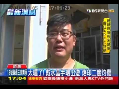 105 10 05 TVBS新聞：太曬了! 戴水晶手環出遊 烙印二度灼傷