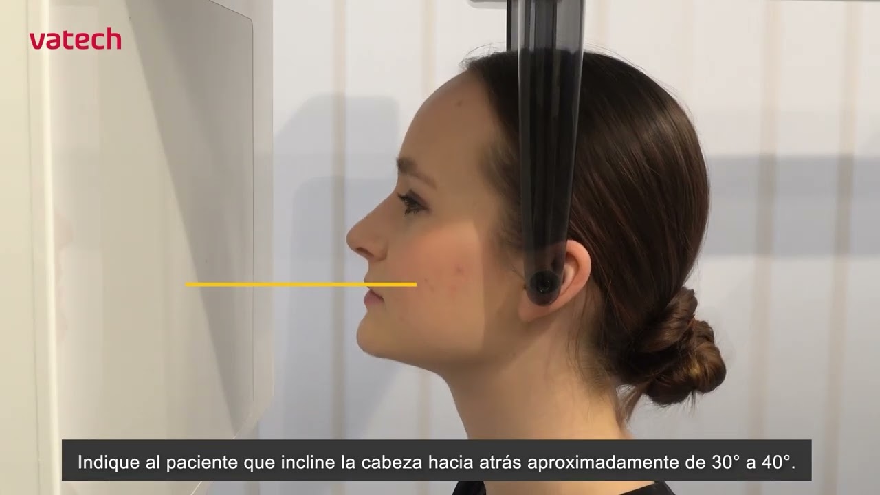 [A9] Posicionamiento CEPH Water's View