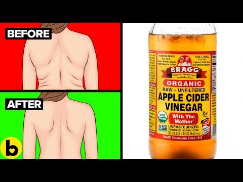 download lagu mp3 mp4 Cider Health Benefits, download lagu Cider Health Benefits gratis, unduh video klip Cider Health Benefits