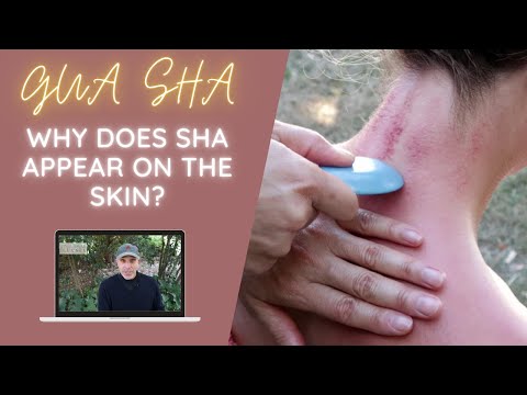 Why does the skin get red dots after Gua sha?