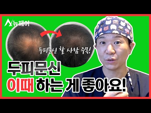 두피문신 시술받기 좋은 나이? #SMPㅣ뉴헤어