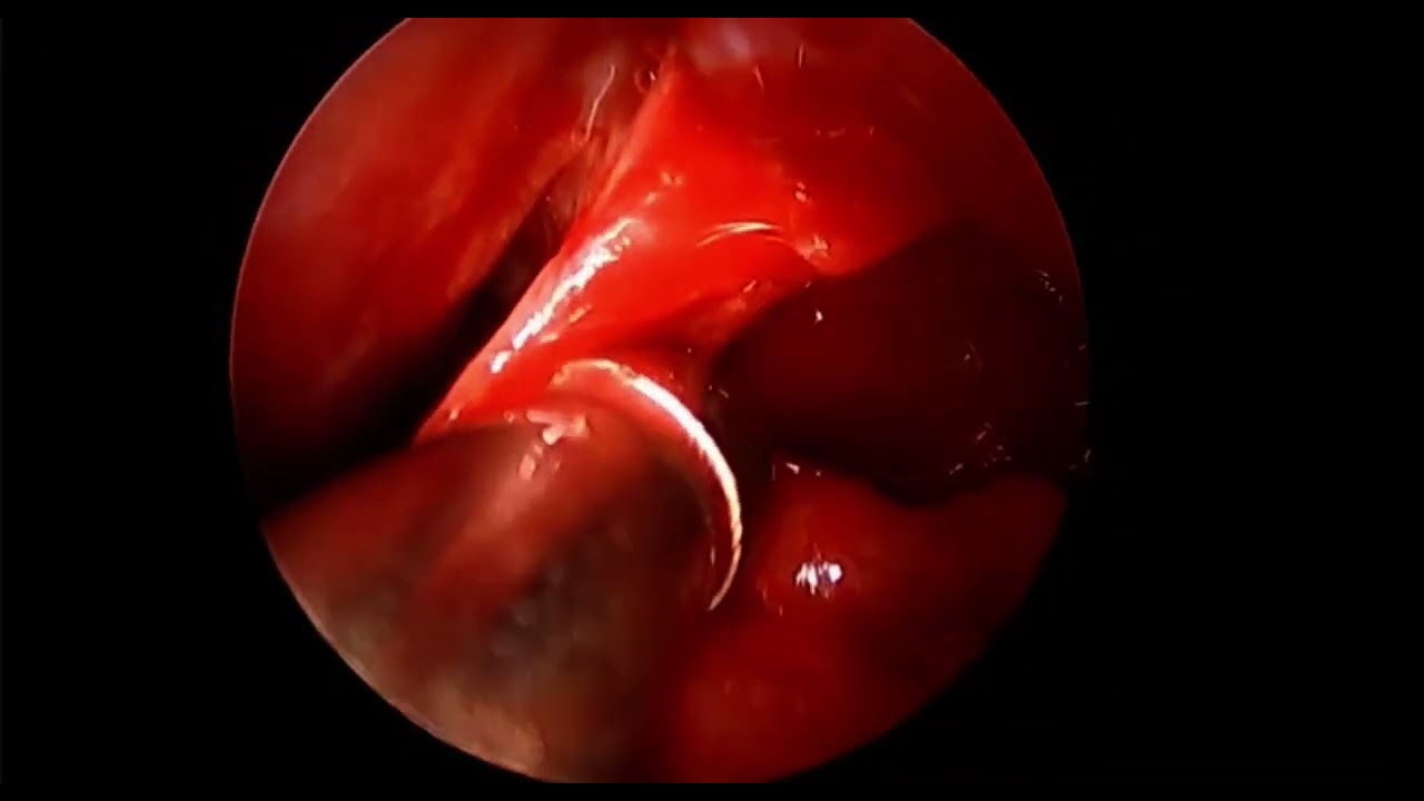 Basilio Capolunghi-5