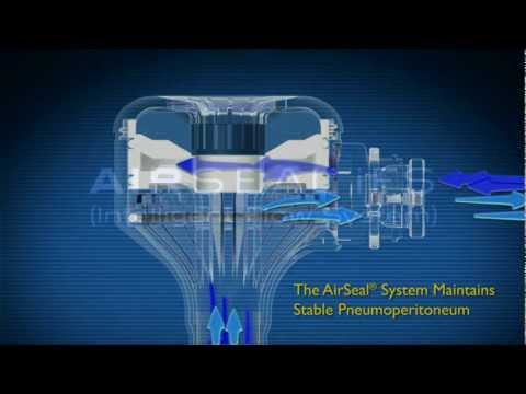 SurgiQuest How AirSeal Works
