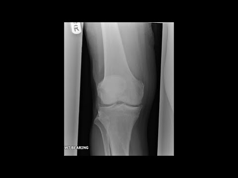 Case of the Day - 13 Jan 24