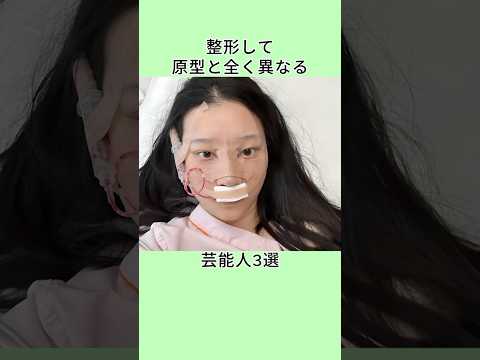 整形して原型と全く異なる芸能人3選 #shorts