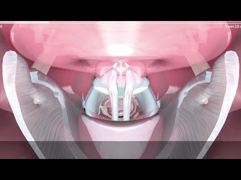 Exploration du conduit vocal