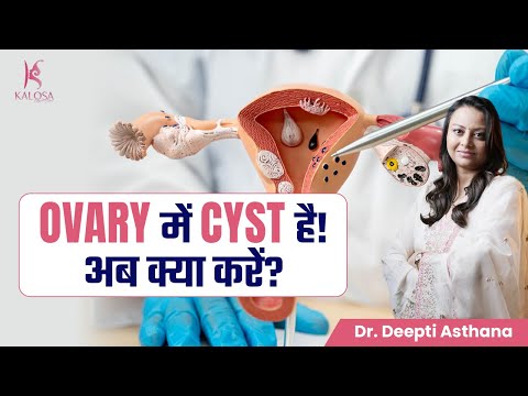 क्या Ovarian Cyst से डरना चाहिए? | Ovarian Cyst Signs And Symptoms | Dr. Deepti Asthana