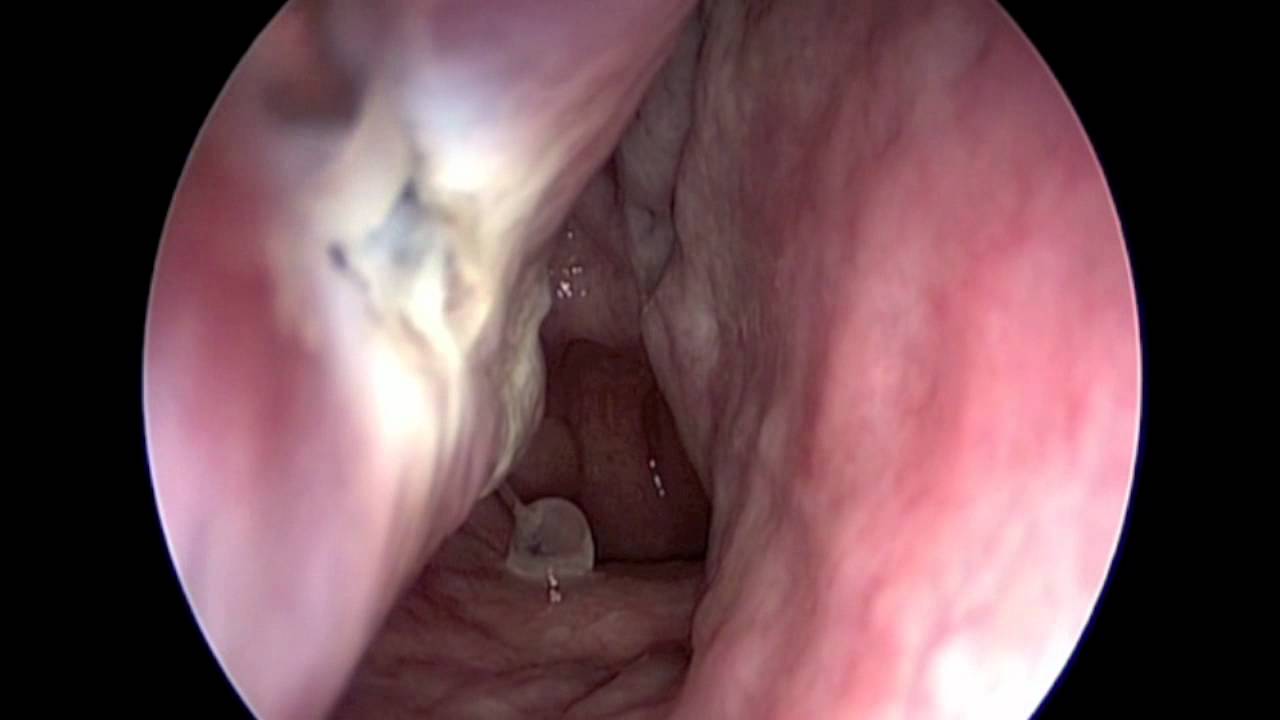 Juan Ramón Benito Navarro-9