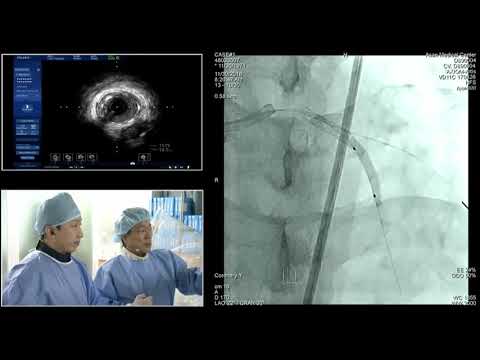 [COMPLEX PCI 2018] Opening & Live Case Demonstration 1