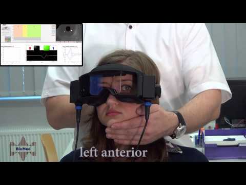 Examination of the semicircular canals RALP and LARP