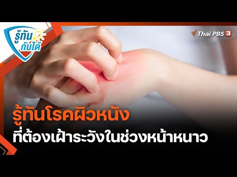 รู้ทันโรคผิวหนัง ที่ต้องเฝ้าระวังในช่วงหน้าหนาว | รู้ทันกันได้